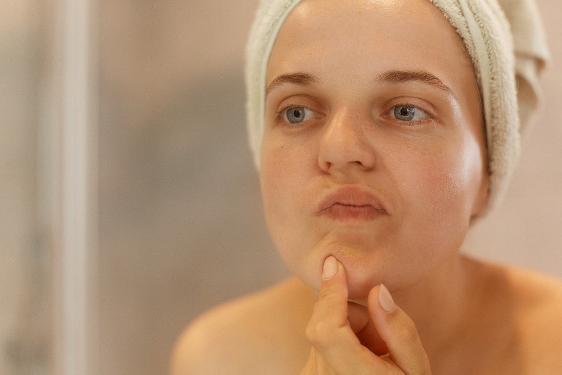 Woman examining her chin closely in the mirror with a towel wrapped around her head.